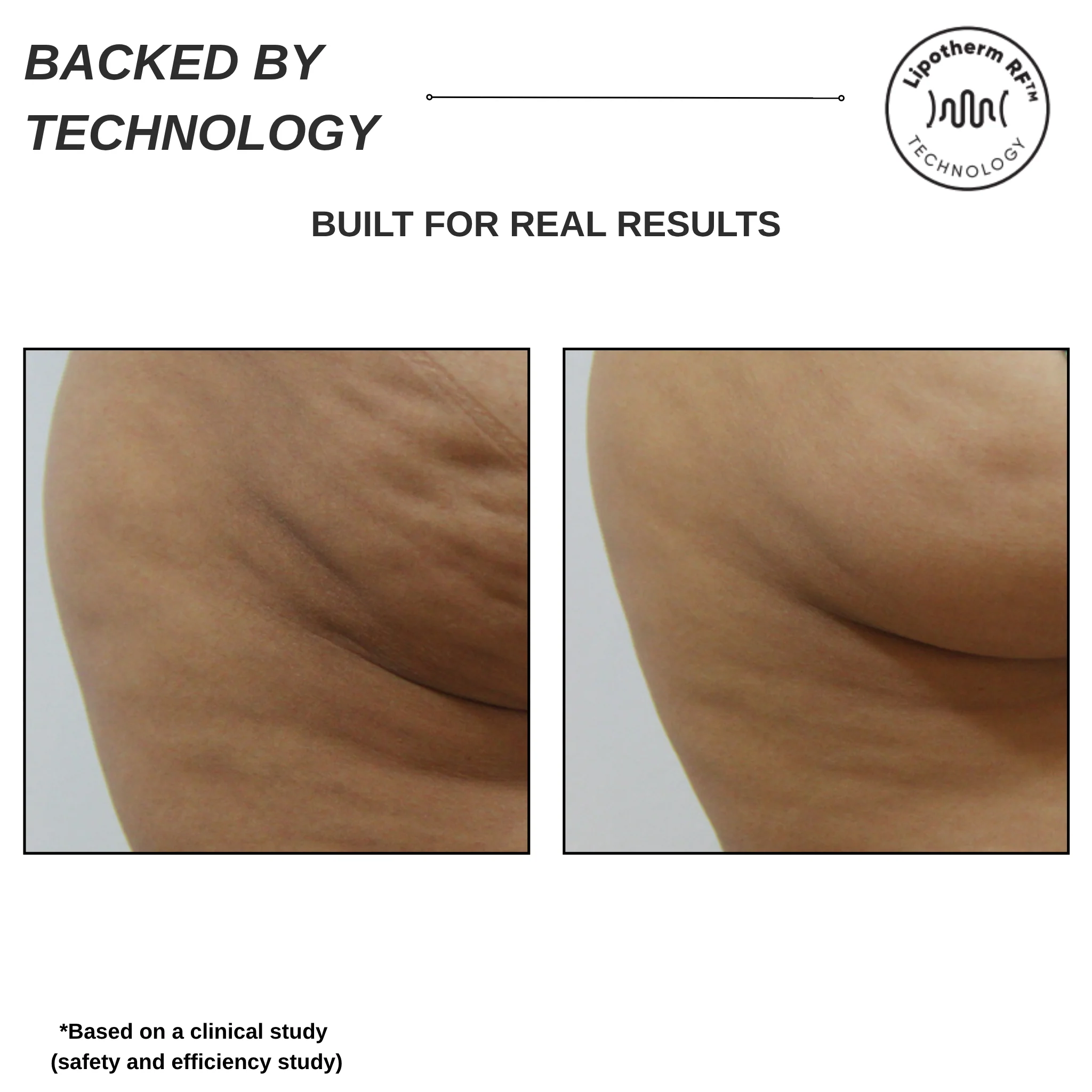 Sensifirm Anti-Cellulite Skin Tightening - Image 5