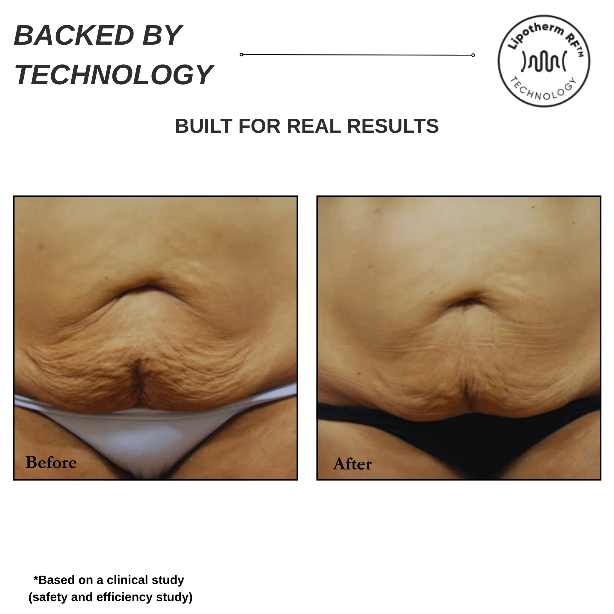 Sensifirm Anti-Cellulite Skin Tightening - Image 6