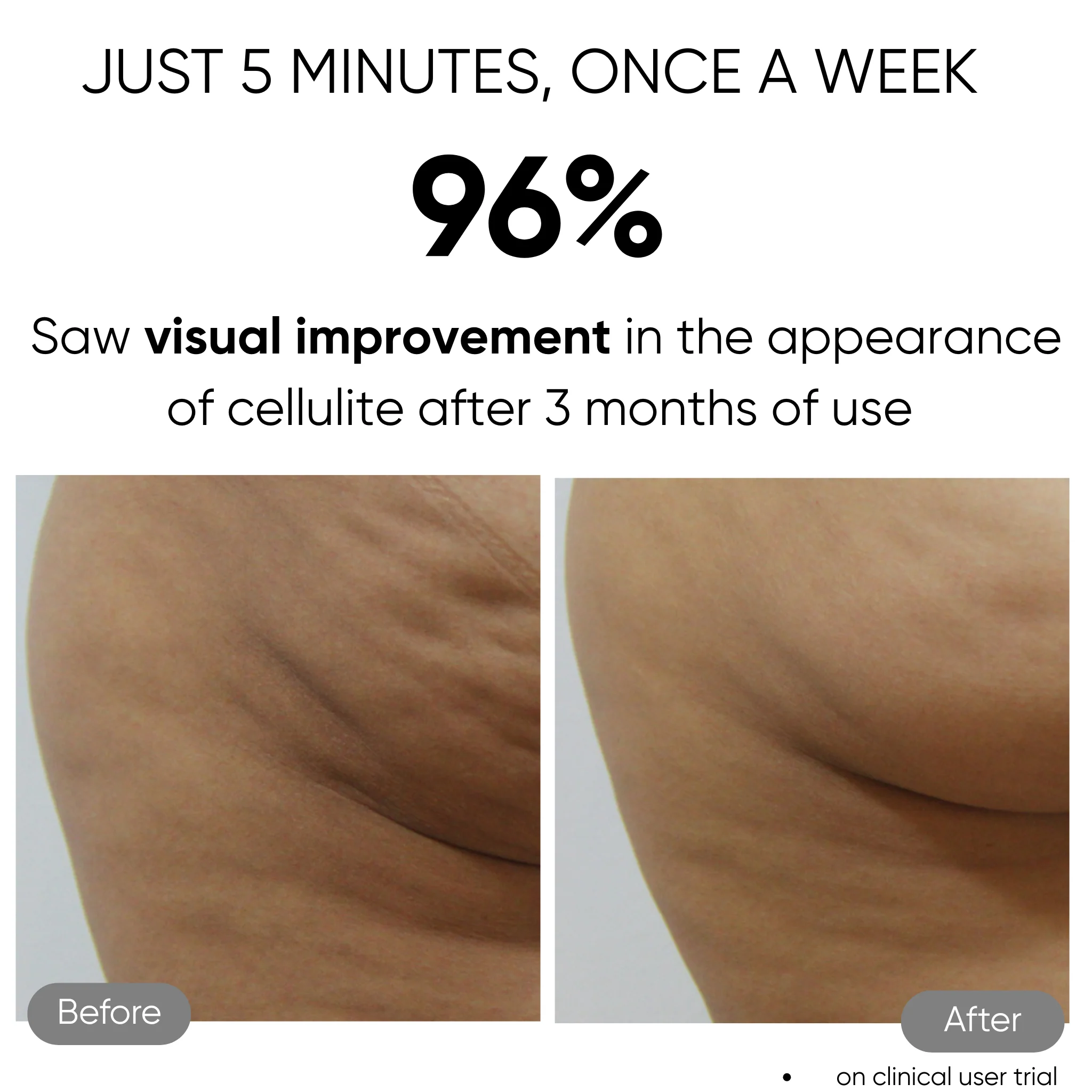 Sensifirm Anti-Cellulite Skin Toning - Image 9