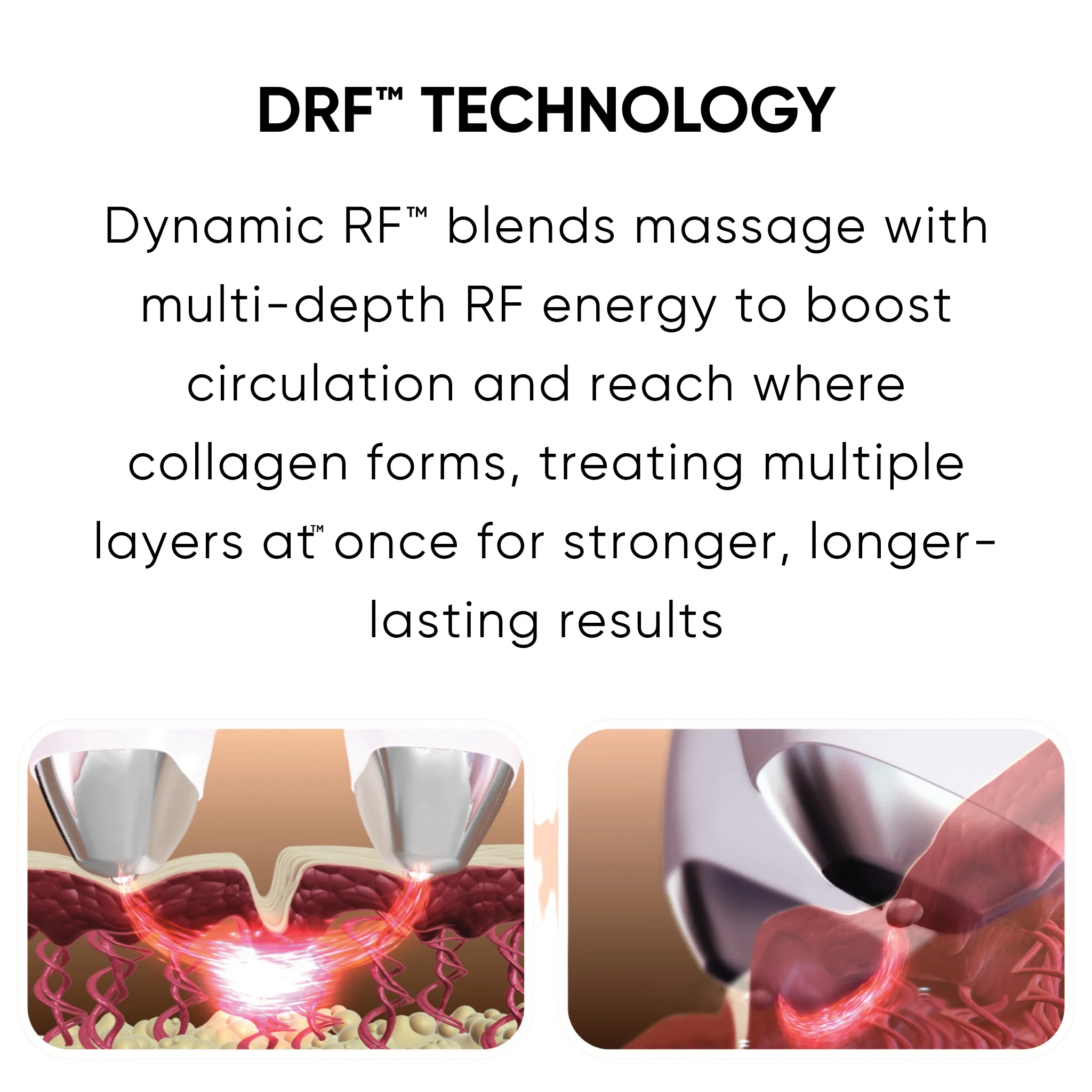 Sensilift Smart RF Skin-Firming - Image 13