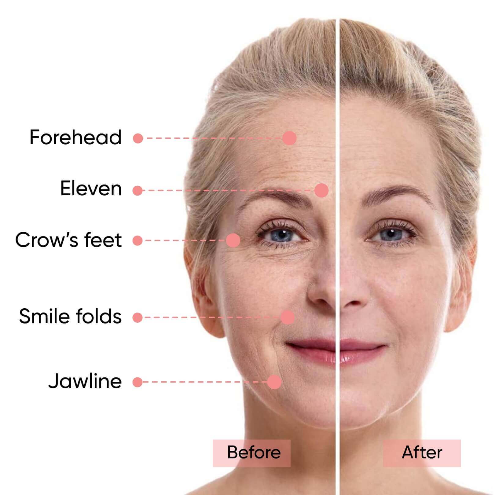 Sensilift At-Home Skin-Firming - Image 4